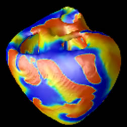 Detailed, multi-scale modeling and simulation of electrical patterns in the heart (spiral waves) 